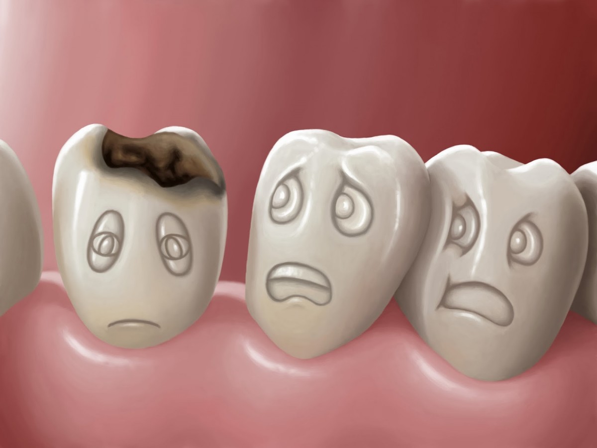 84_karies-zubov-simptomy-dia